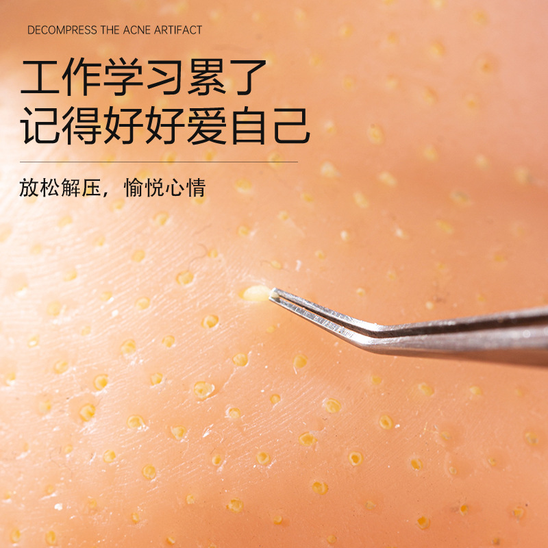 Stress relief, pimple squeeze, - đánh giá và giá Dolls